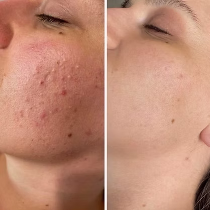 Professional facial treatment