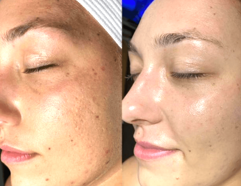 Skincare treatment session